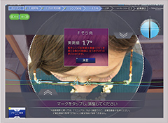 そり角